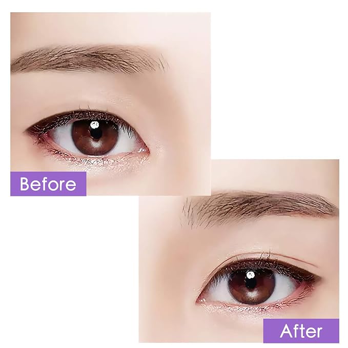 7MM Eyelid Lift Tapes Eyelid Correcting Strips for Heavy Hooded Droopy Eyes