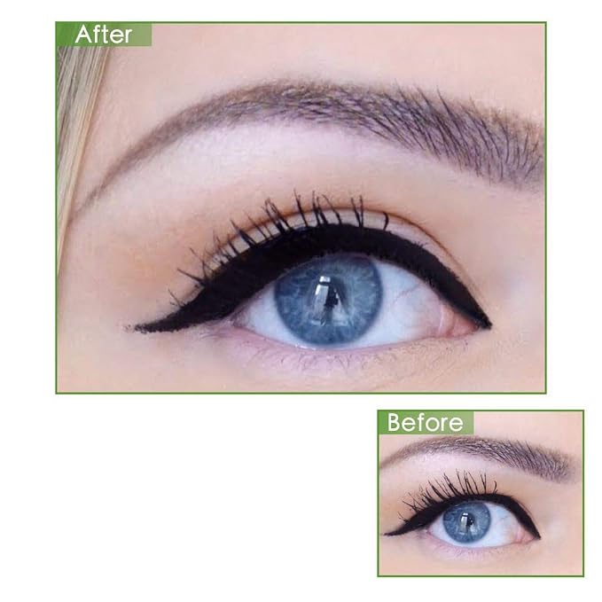 5MM Skin color Eyelid Tape Stickers Invisible Eyelid Correcting Stripes Eyelid Lift Strips, Eye lid Lift Without Surgery Stay 24 hours, for Hooded, Droopy, Uneven, Mono-eyelids