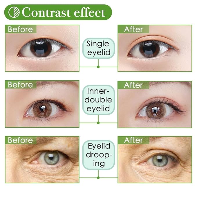 5MM Eyelid Tape Stickers Eyelid Lift Strip Correction for Moderate Sagging